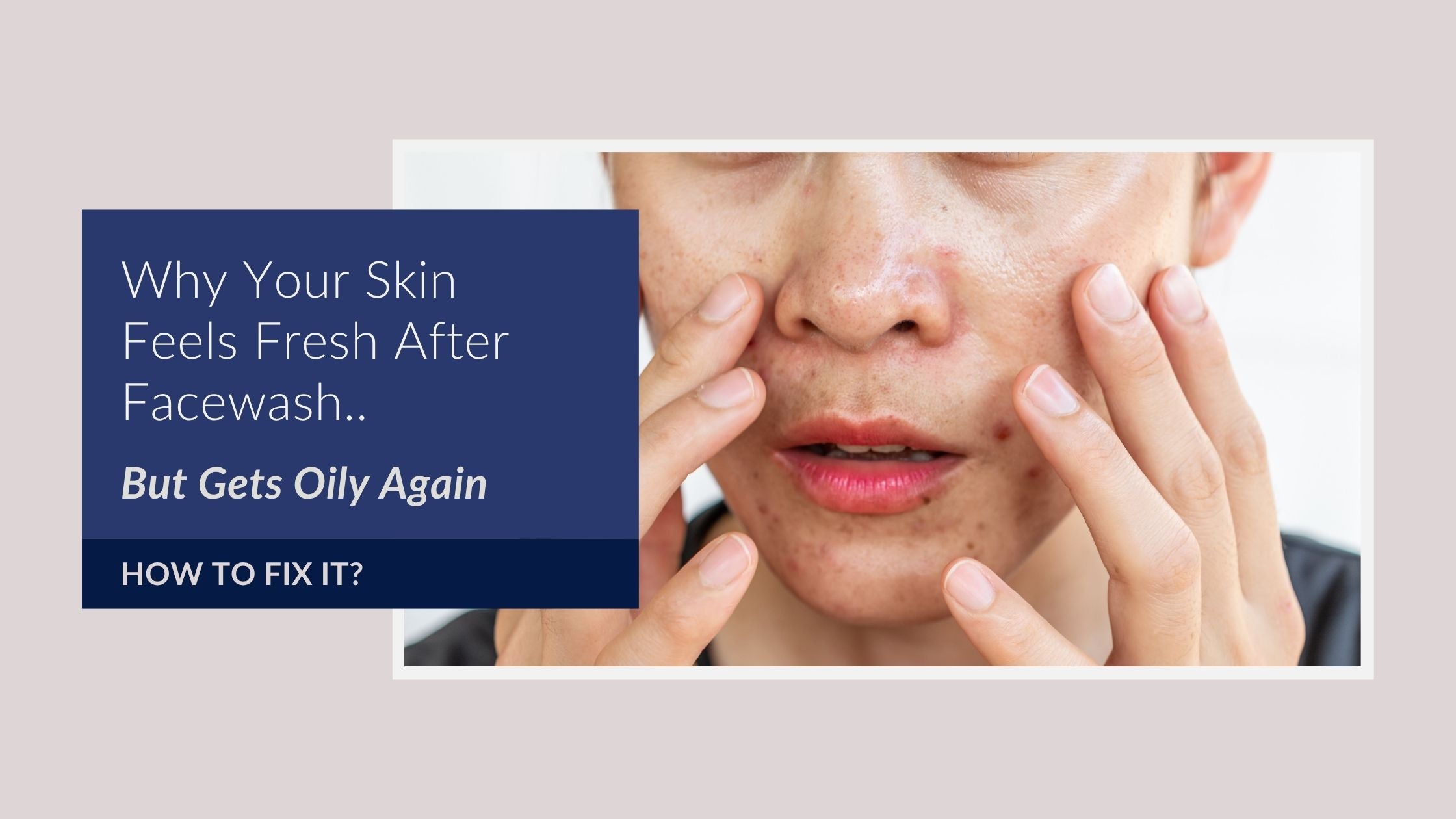 Why Your Skin Feels Fresh After Facewash…But Gets Oily Again (How to Fix It)